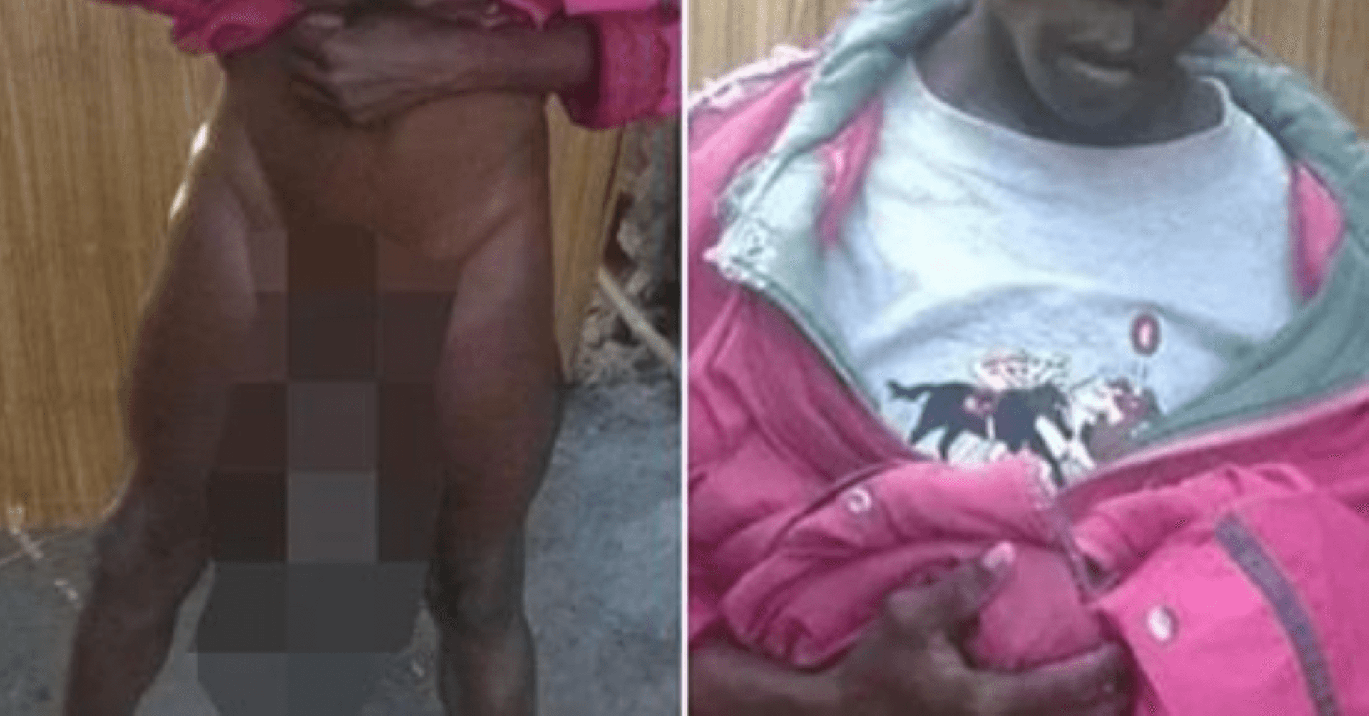 Keniani nuk mund të bëjë seks – E ka organin gjenital 10 herë mbi madhësinë mesatare (FOTO)