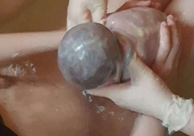 E rrallë: Bebja lind me “këmishë”