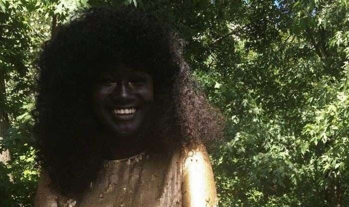 Modelja me ngjyrën e veçantë të lëkurës