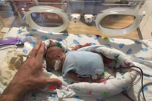 Mjekët heronj shpëtojnë foshnjen që peshonte më pak se 500 gram