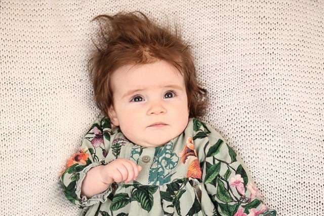 Bebe me kaq shumë flokë nuk keni parë (FOTO)