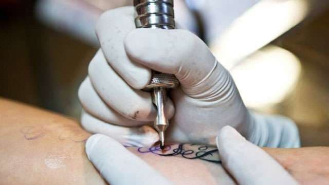Çfarë duhet të keni parasysh para se të fshini një tatuazh?