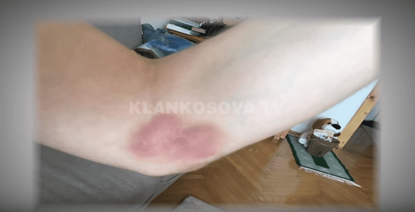 Aktorët e Teatrit Kombëtar vazhdojnë grevën (VIDEO)