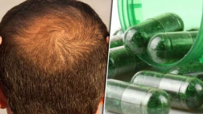 Këto janë vitaminat dhe ushqimet që ndalojnë rënien e flokëve