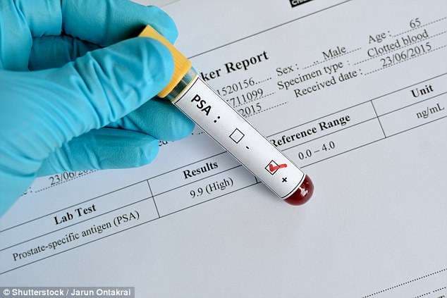 Testi i ri për kancerin e prostatës eliminon nevojën e biopsive