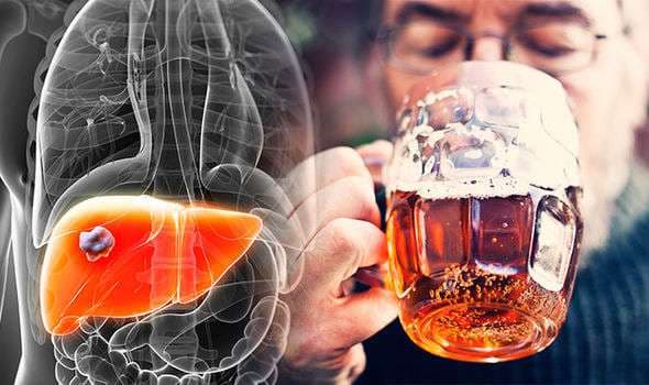 Alkooli i pakontrolluar dëmton mëlçinë