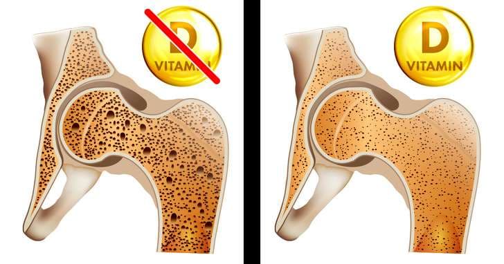 Shenjat se keni nevojë për më shumë vitaminë D