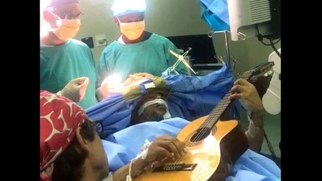 Muzikanti që u operua zgjuar, performoi me kitarë (VIDEO)