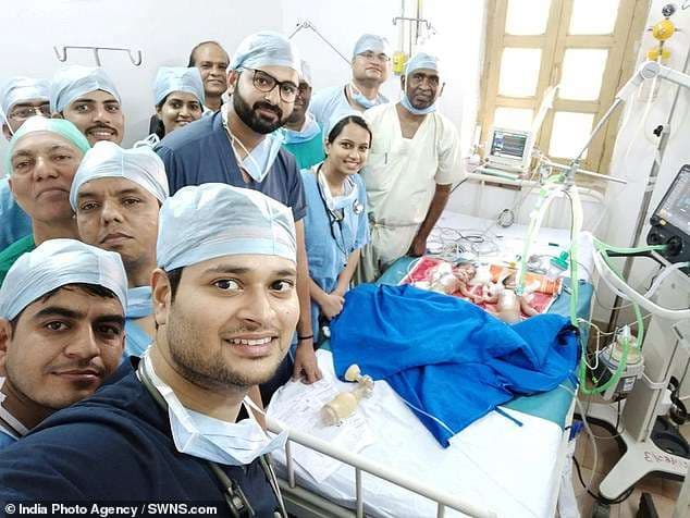Kirurgët festojnë me një 'selfie' operacionin e suksesshëm për ndarjen e binjakeve