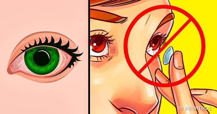Si të kujdeseni për sytë e ndjeshëm?