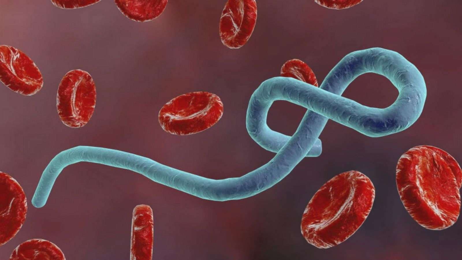 Ebola hyn në dhjetëshen e kërcënimeve globale shëndetësore