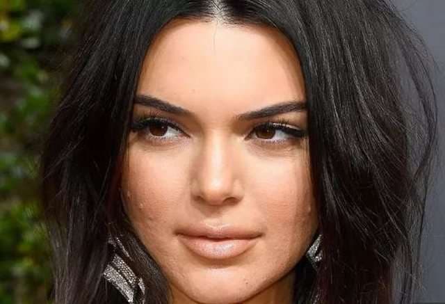 Kendall rrëfen për herë të parë të vërtetën