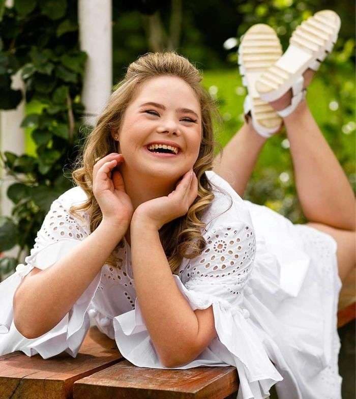Adoleshentja me Sindromën Down që punoi për pesë agjenci të modës (FOTO)