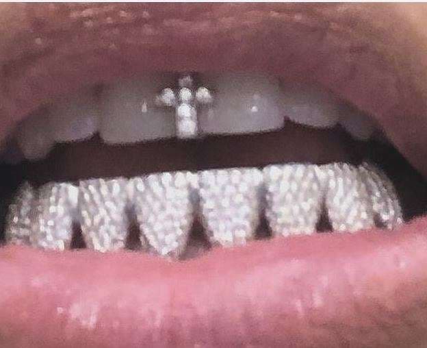Kim Kardashian vesh dhëmbët me gur diamanti