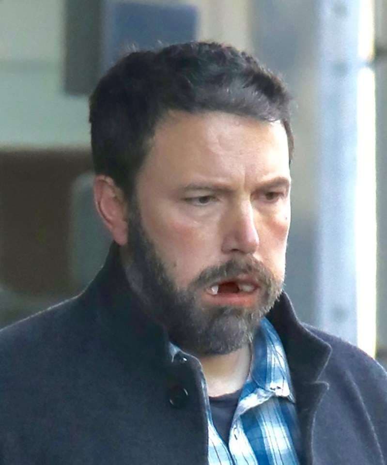 Çfarë i ka ndodhur gojës së Ben Affleck?
