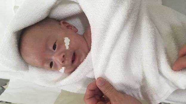 Djali më i vogël në botë lirohet nga spitali