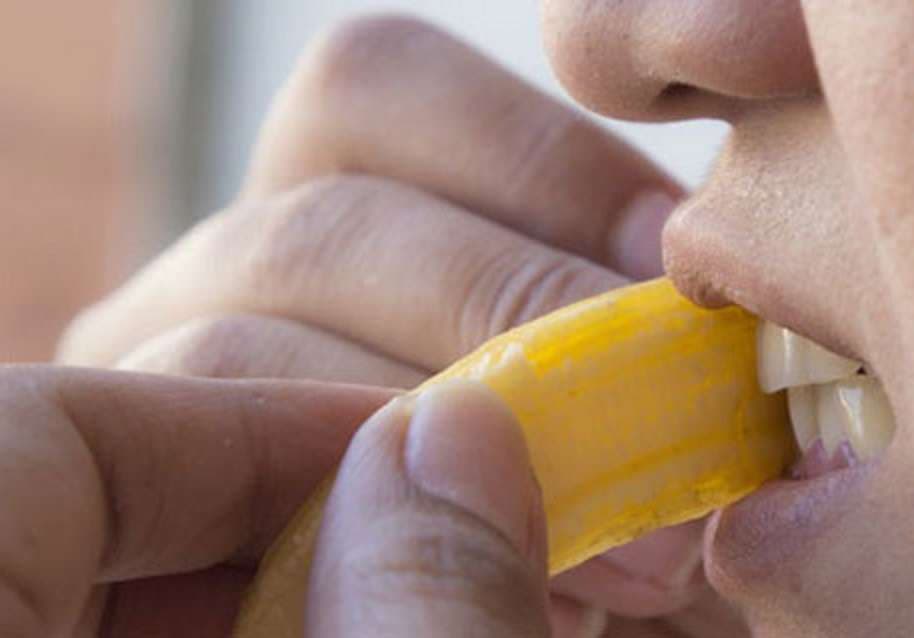 Zbardhni dhëmbët shëndetshëm me lëvoret e bananeve
