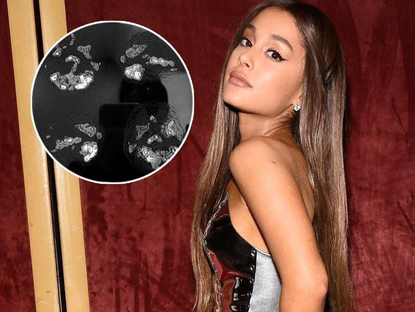 Ariana poston fotografi të trurit të saj të traumatizuar
