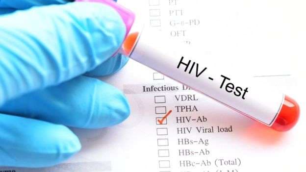 Studim: Transmetimi i HIV tek homoseksualët që përdorin ilaçe është zero