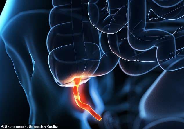 Pacientët që heqin apendiksin rrezikohen trefish nga sëmundja e Parkinsonit