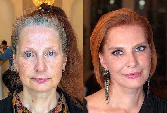 Nuk keni nevojë për kirurgji plastike që të dukeni e mahnitshme