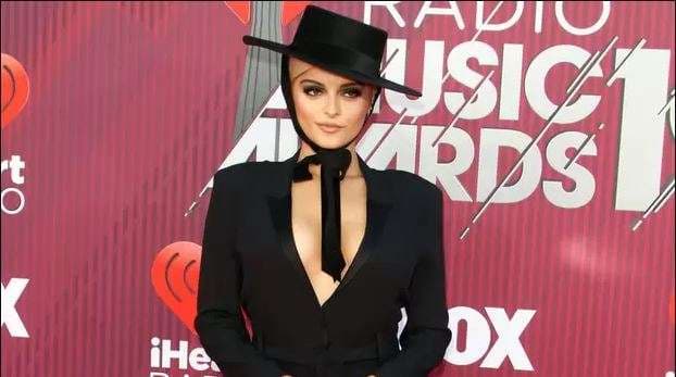 Bebe Rexha tregon se Katy Perry e ndihmoi të largojë stresin e rrjeteve sociale