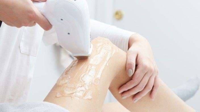 Gjithçka çfarë duhet të dini para se të hiqni qimet me laser