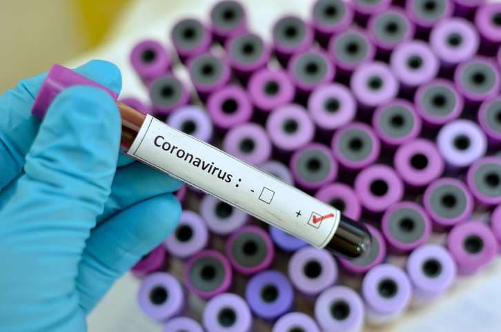 Sot pritet të fillojnë testimet serologjike
