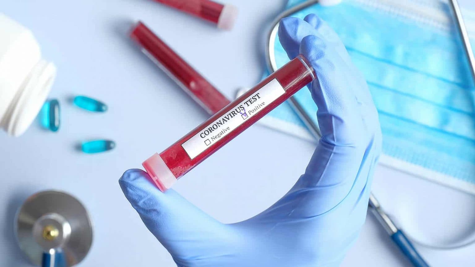 Mbi 10 mijë holandezë të infektuar me koronavirus