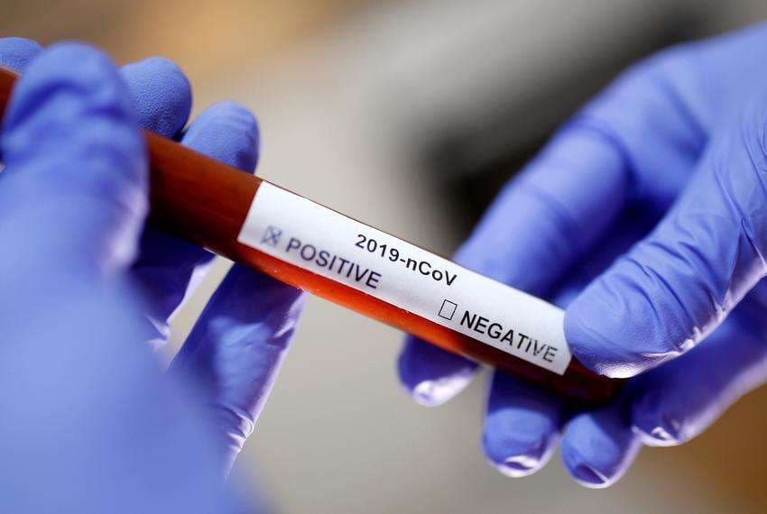 Edhe katër raste me koronavirus, shkon në 28 numri i të prekurve