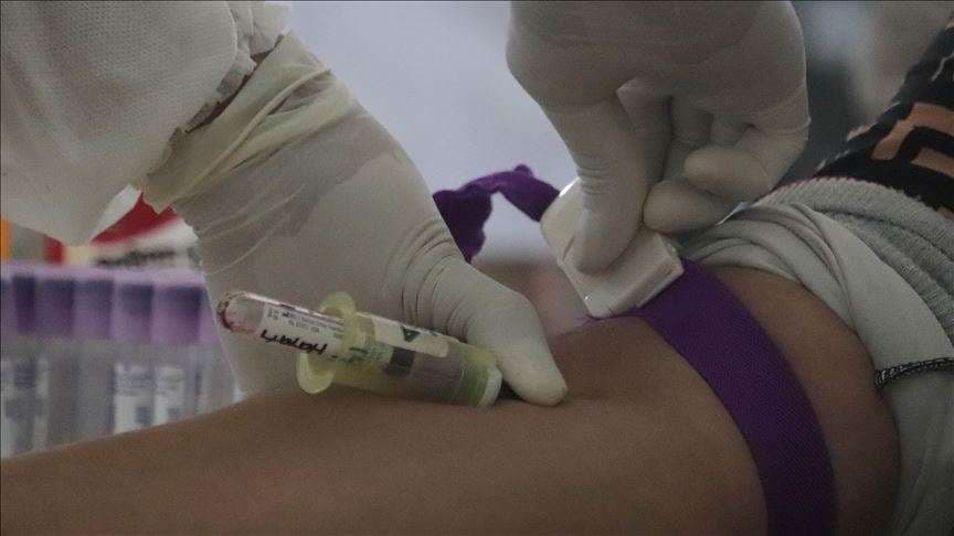 Numri i të shëruarve nga koronavirusi në mbarë botën kalon 300 mijëshin