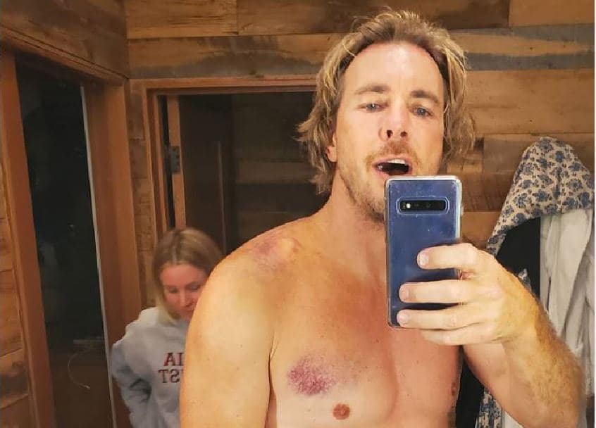 Dax Shepard aksidentohet me motoçikletë, thotë se duhet t'i nënshtrohet një operacioni