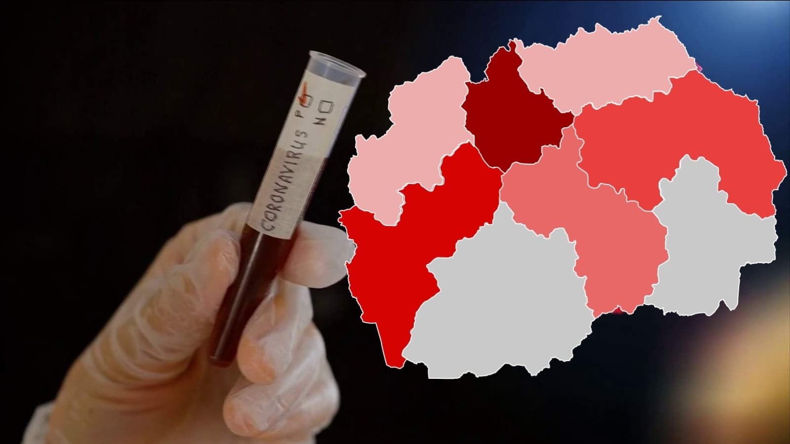 Shtatë të vdekur nga COVID-19 në Maqedoninë e Veriut, 301 raste të reja
