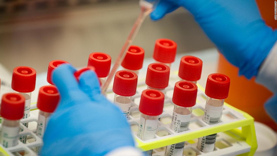 13 raste të reja me koronavirus në Maqedoninë e Veriut