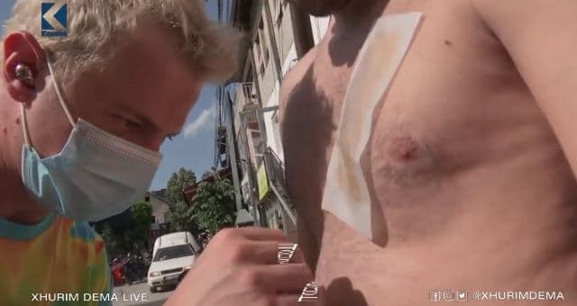 Qytetari depilohet live tek "Humbësi fiton" (VIDEO)