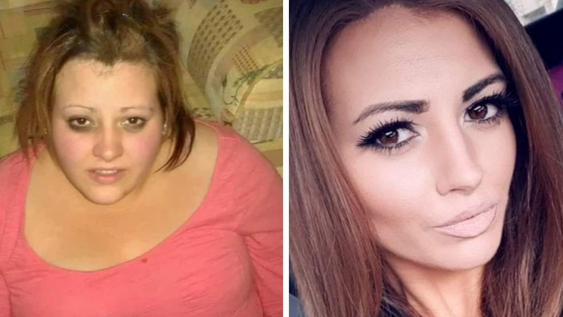 Qau pasi e pa veten në një fotografi, gruaja humbi rreth 77 kilogramë