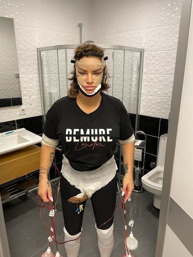 Katie Price rrëfen përvojen me operim plastik: Ishte e tmerrshme