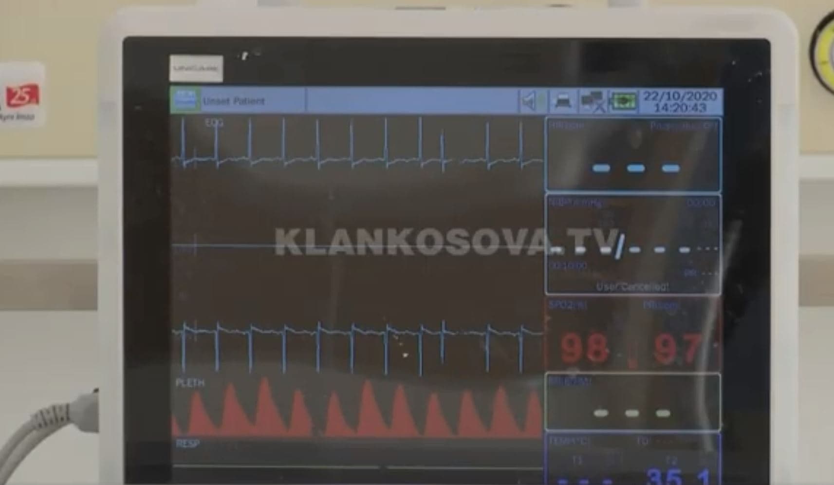 24 persona vdesin nga COVID-19, në mesin e tyre edhe një foshnje trejavëshe (VIDEO)