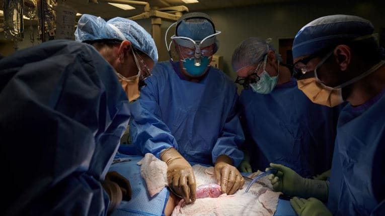 Kirurgët amerikanë testuan me sukses transplantin e veshkës së derrit tek një njeri