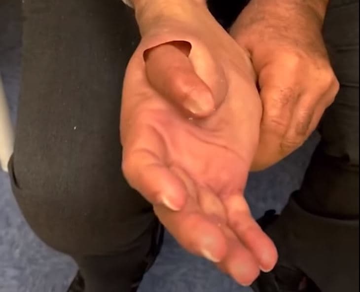 Protezat që duken si gishta të vërtetë (VIDEO)