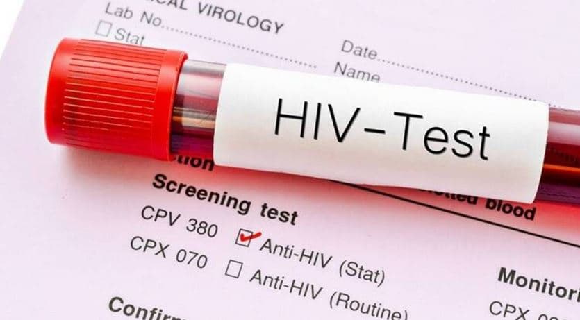 Njihuni me simptomat e hershme të HIV-it