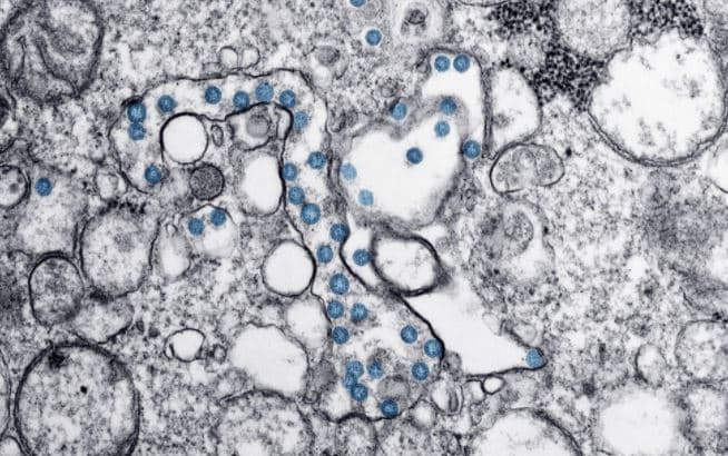 Studimi: Antitrupat Omicron mund të bllokojnë infeksionin e variantit Delta