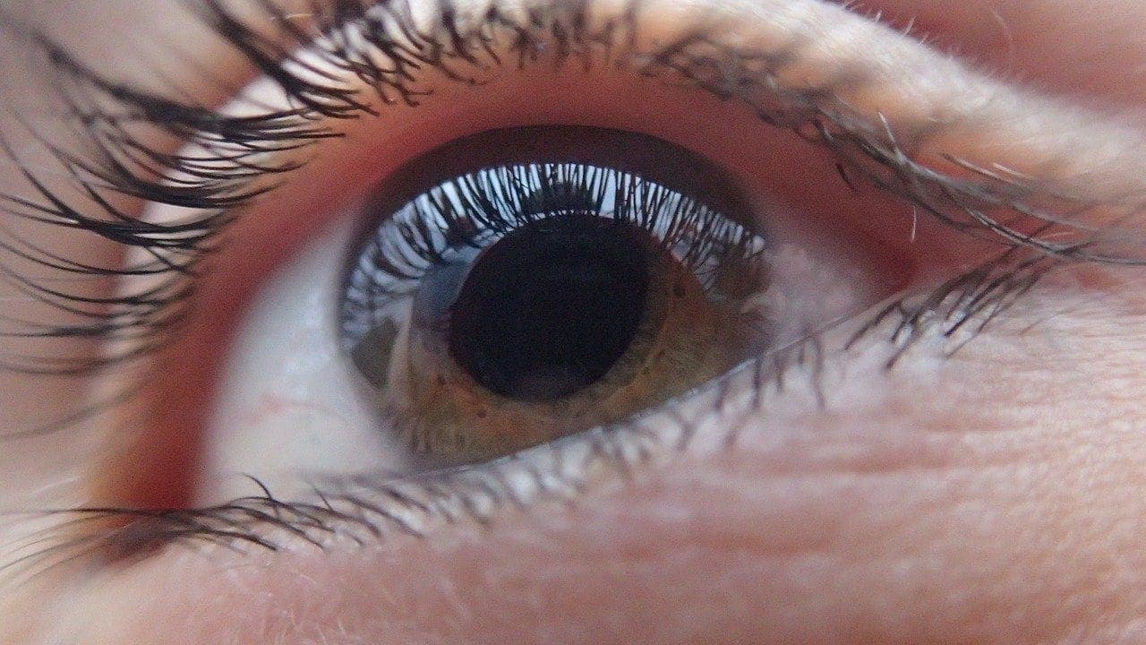 Simptomat e Glaukomës që nuk duhet t’i injoroni