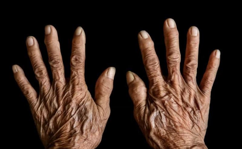 Një studim i ri gjenetik po planifikon parandalimin e plakjes