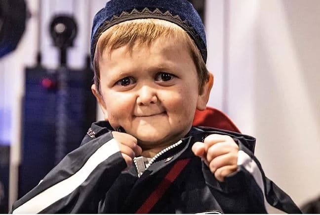Pse Hasbulla nuk bën dot foto me femra?