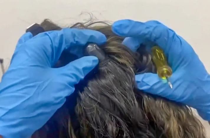 Arrestohen dy gra në Kolumbi, i kishin fshehur 2 kilogramë kokainë në flokë (FOTO)