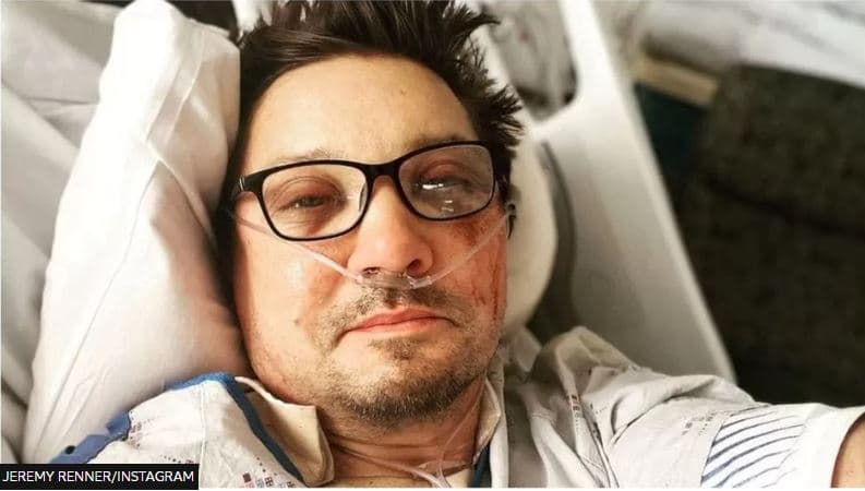 Aktori Jeremy Renner i theu mbi 30 kocka pasi u godit nga makina për pastrimin e borës