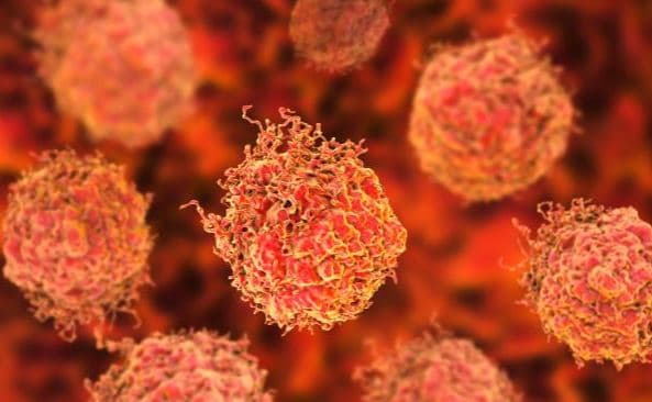 Meshkujt që shtojnë peshë në moshë kritike janë më të rrezikuar nga kanceri i prostatës