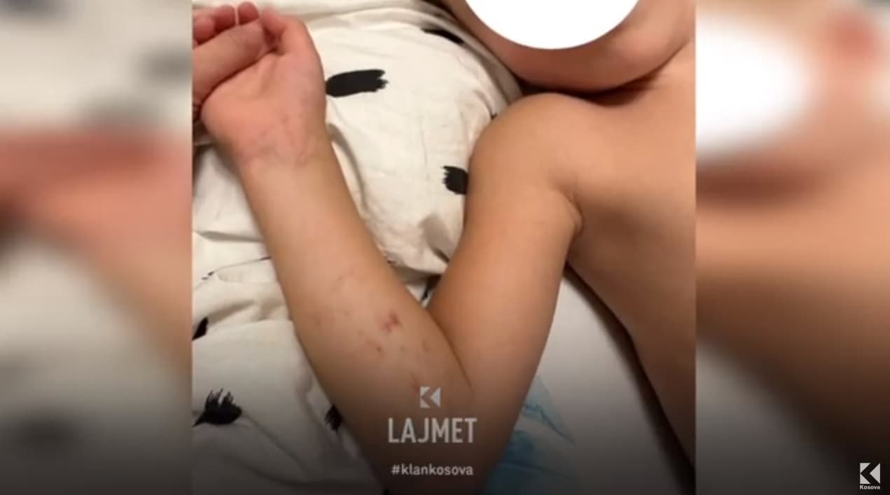 Krejt çka ndodhi me rastin e dhunës në kopshtin "Gëzimi Ynë" (VIDEO)