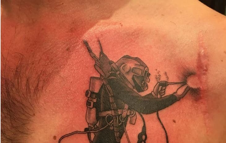 Tatuazhet që i kthyen plagët e trupit në art